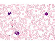 Blut/Mensch Präparate und Foliensätze 2