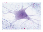 Nervenzellen (Rückenm ) quer Präparate und Foliensätze