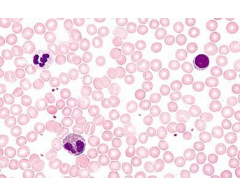 Blut/Mensch Präparate und Foliensätze